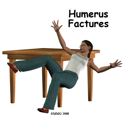 Adult Humerus Fractures